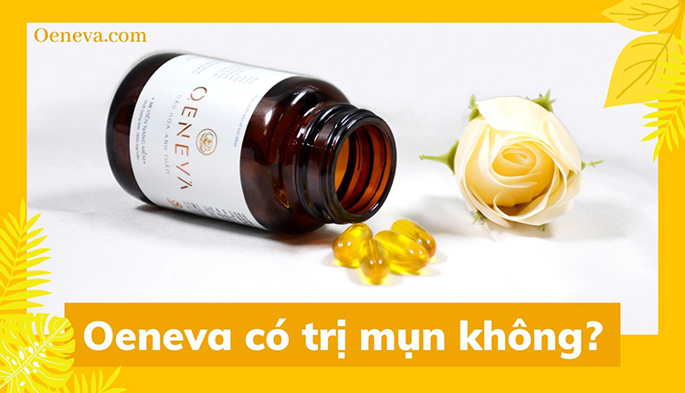Oeneva có trị mụn không? Dùng như thế nào? 1 Oeneva có trị mụn không? Dùng như thế nào? 1