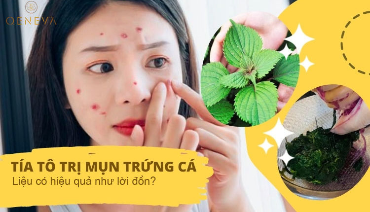 cach-tri-mun-bang-tia-to