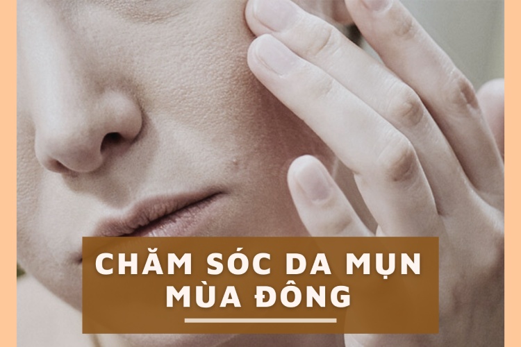 10 bí kíp chăm sóc da mụn mùa đông cần thiết cho chị em 1