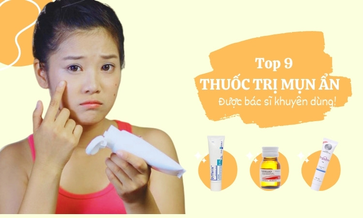 Top 9 thuốc trị mụn ẩn được bác sĩ khuyên dùng 1