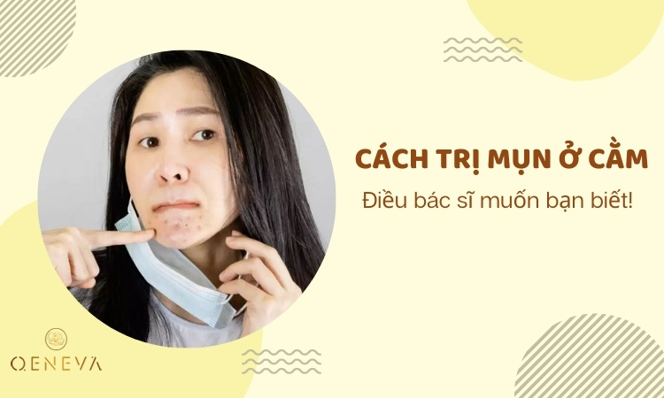 Cách trị mụn ở cằm:  Cách trị mụn ở cằm: