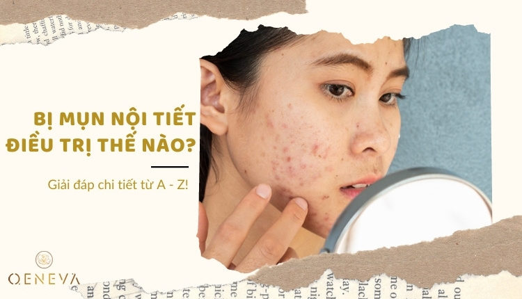 cach-tri-mun-noi-tiet