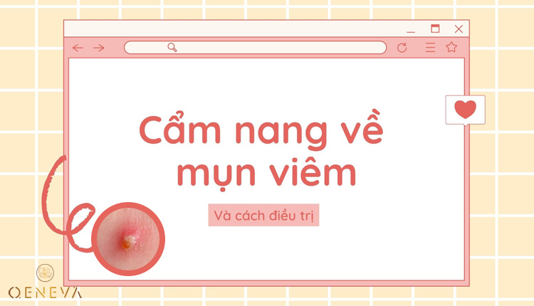 Cẩm nang về mụn viêm và cách điều trị 1 Cẩm nang về mụn viêm và cách điều trị 1