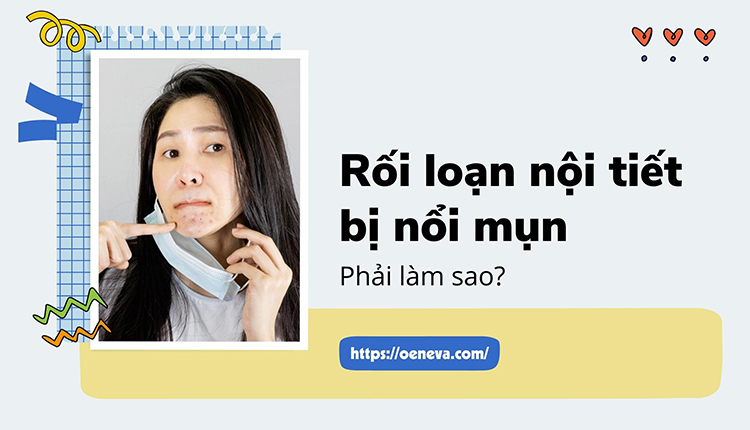 Rối loạn nội tiết tố bị nổi mụn phải làm sao? 1 Rối loạn nội tiết tố bị nổi mụn phải làm sao? 1