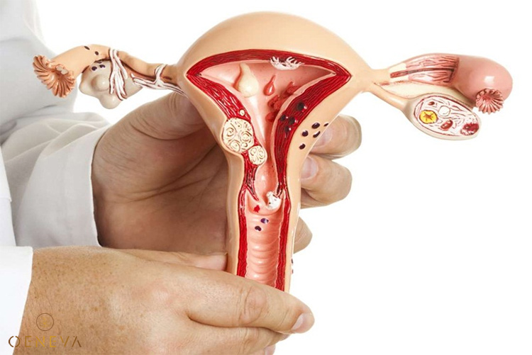 U xơ có uống được hoa anh thảo không? 1