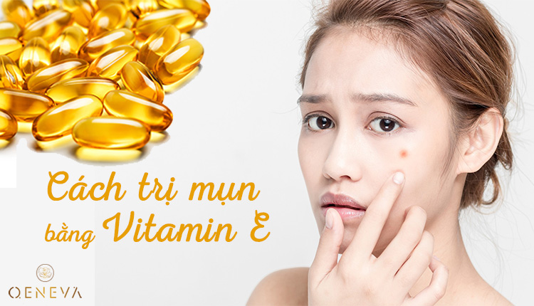 Trị mụn bằng vitamin E đúng cách, nàng đã thử chưa? 1 Trị mụn bằng vitamin E đúng cách, nàng đã thử chưa? 1