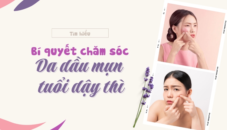 Bí quyết chăm sóc da dầu mụn tuổi dậy thì đầy đủ nhất 1