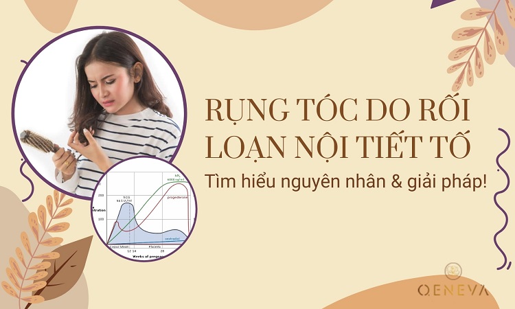 Vì sao rối loạn nội tiết gây rụng tóc? Xem giải pháp! 1 Vì sao rối loạn nội tiết gây rụng tóc? Xem giải pháp! 1