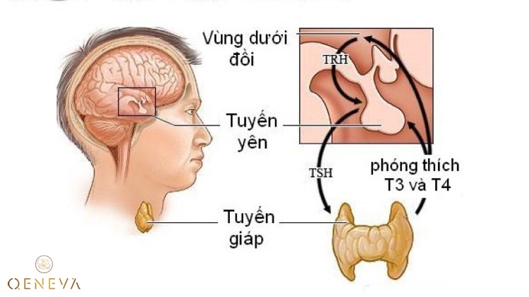 3.5. Bệnh tuyến giáp 1