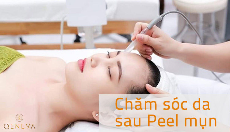 5 điều nàng cần nhớ để chăm sóc da sau peel mụn 1 5 điều nàng cần nhớ để chăm sóc da sau peel mụn 1