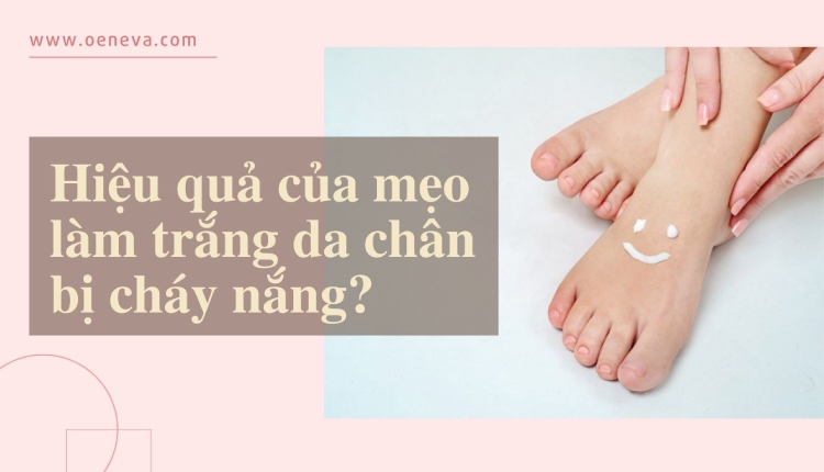 Làm trắng da chân bị cháy nắng tại nhà có hiệu quả? 1
