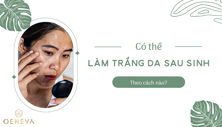 Cách làm trắng da sau sinh nào an toàn và hiệu quả? 1 Cách làm trắng da sau sinh nào an toàn và hiệu quả? 1