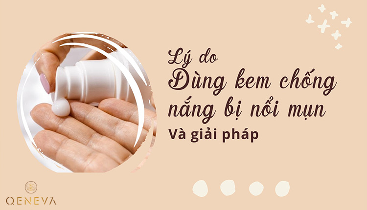 Vì sao dùng kem chống nắng bị nổi mụn? 1