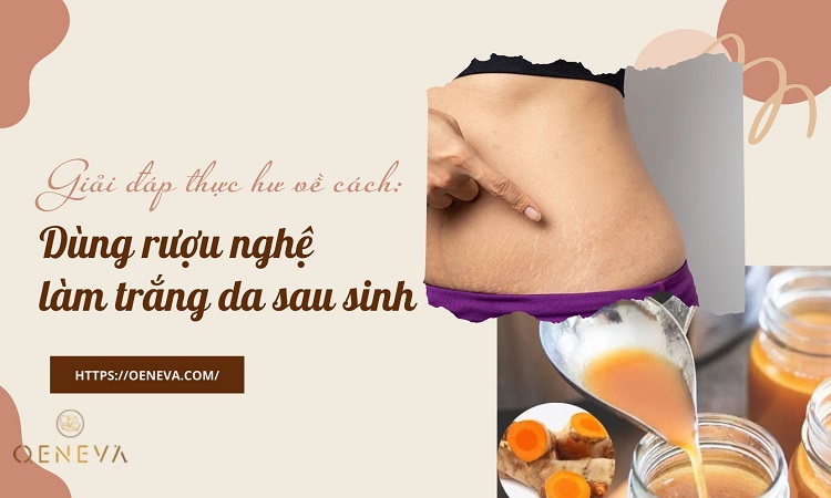 Cách làm trắng da sau sinh bằng rượu nghệ hiệu quả 1 Cách làm trắng da sau sinh bằng rượu nghệ hiệu quả 1