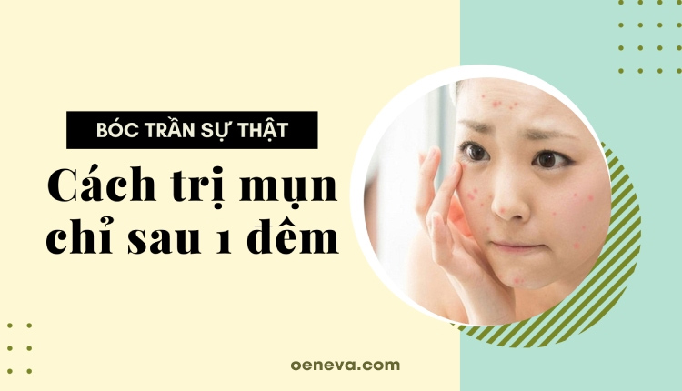 Bóc trần sự thật về những cách trị mụn hiệu quả sau 1 đêm 1 Bóc trần sự thật về những cách trị mụn hiệu quả sau 1 đêm 1