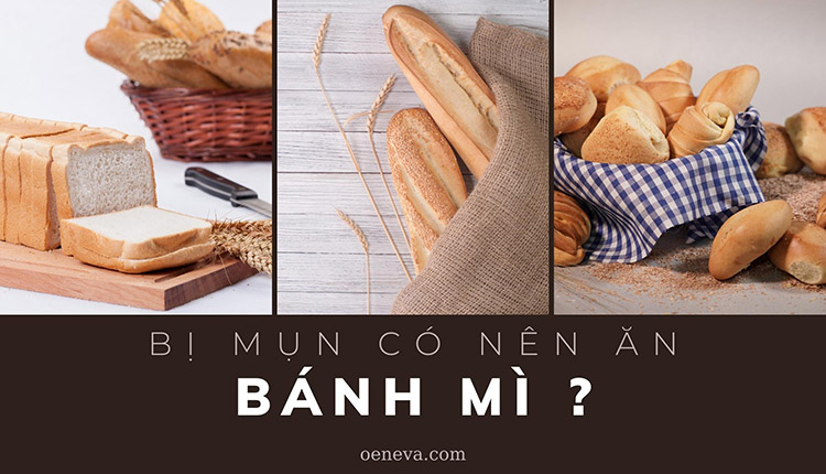 Xem ngay: Bị mụn có nên ăn bánh mì hay không? 1 Xem ngay: Bị mụn có nên ăn bánh mì hay không? 1
