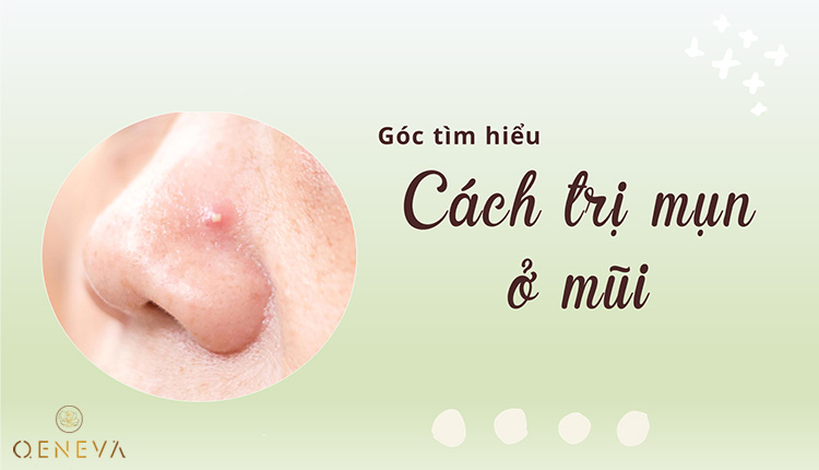 Các cách trị mụn ở mũi: kem bôi, thuốc uống, laser, peel, tiêm 1 Các cách trị mụn ở mũi: kem bôi, thuốc uống, laser, peel, tiêm 1