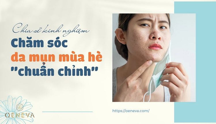 cham-soc-da-mun-mua-he