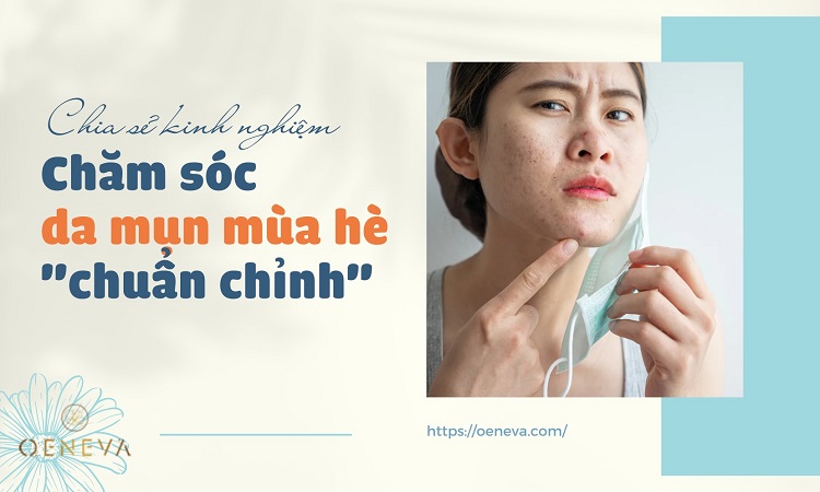 Cách chăm sóc da mụn mùa hè 