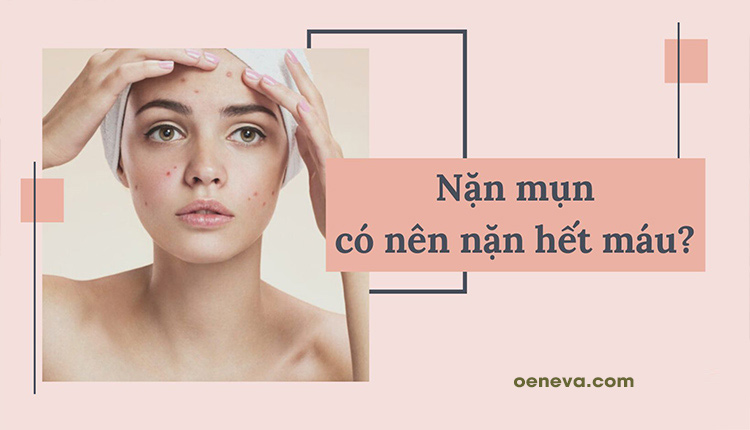 Nặn mụn có nên nặn hết máu? 1 Nặn mụn có nên nặn hết máu? 1