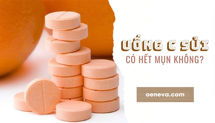 Uống C sủi có hết mụn không? Uống thế nào là đúng? 1 Uống C sủi có hết mụn không? Uống thế nào là đúng? 1