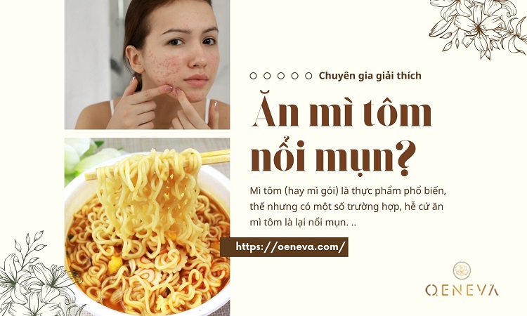 5. Giải pháp cải thiện tình trạng mụn khi ăn mì