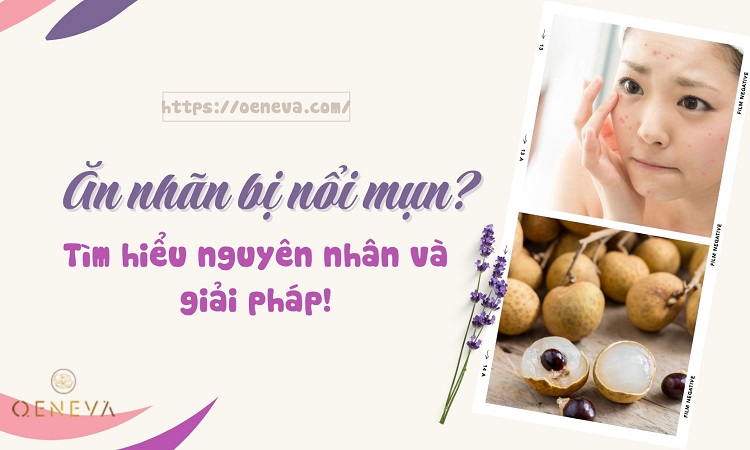 Ăn nhãn có nổi mụn không? - Giải đáp chi tiết 1