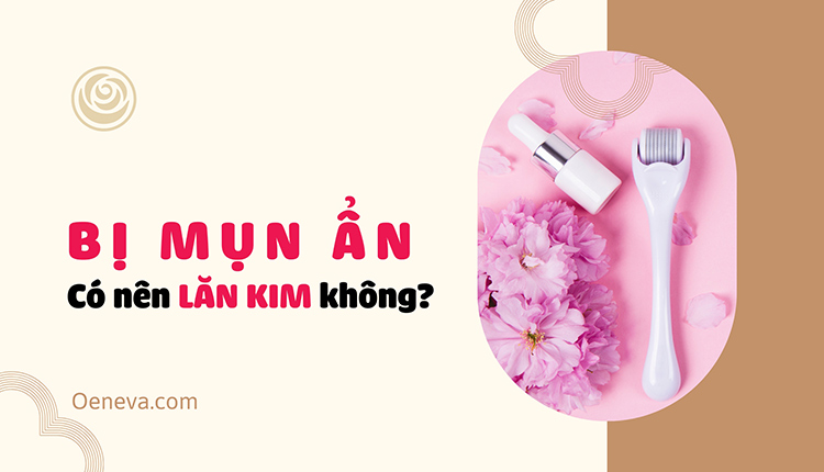 Bị mụn ẩn có nên lăn kim không? Cần lưu ý gì? 1
