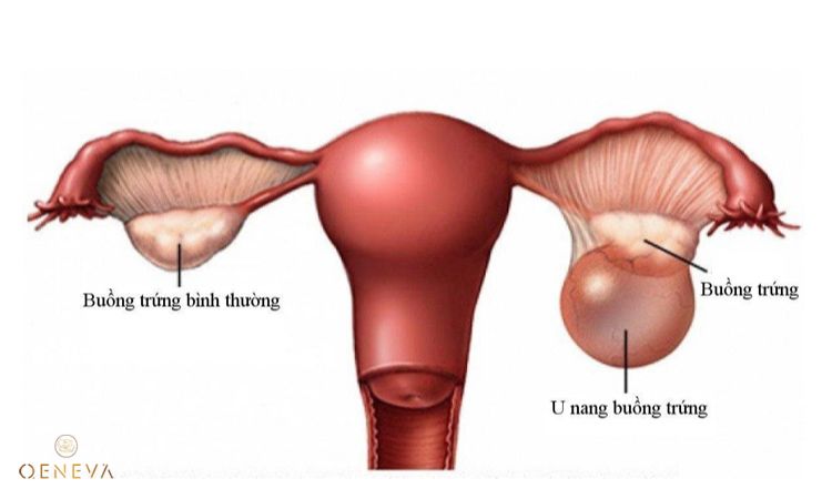 1.2. Nguyên nhân bệnh lý 2 1.2. Nguyên nhân bệnh lý 2